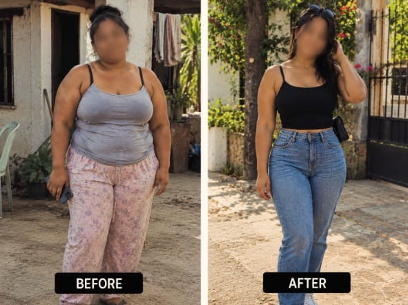 Female client body transformation - Waist and silhouette recomposition
